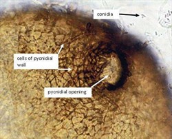 Photo 4. A spore-containing sac (pycnidia) of Ascochyta spot, Boeremia exigua.