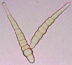 Photo 4. Spores of grey leaf spot, Alternaria brassicae. Compare with spores of Alternaria brassicicola (see Fact Sheet 319).