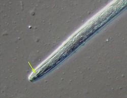 Photo 3. Head of the nematode, Radopholus similis, showing the spear in the mouth that is used to pierce plant cells and suck up the contents.