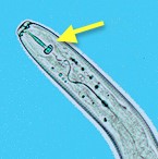Photo 3. The head of Pratylenchus sp. showing the hollow spear or stylet (arrow), which is used to puncture cells in order to move through the roots, as well as to feed on their contents.